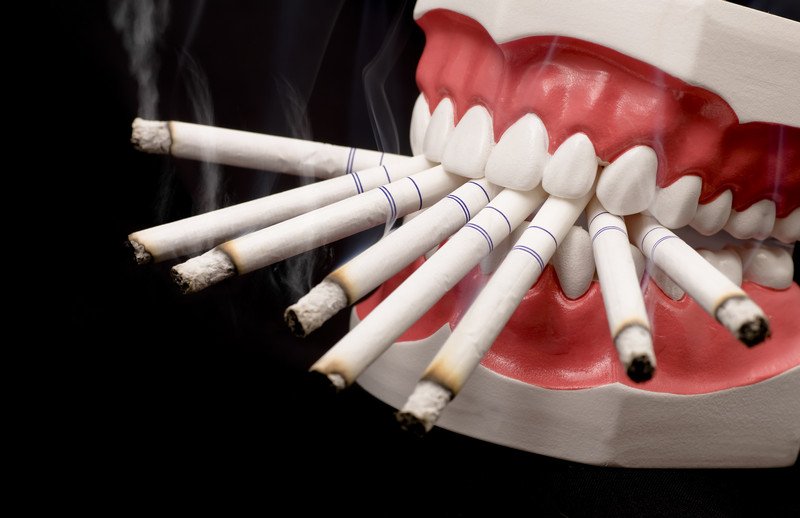 PennaOrtho's tweet photo. Talk to your teens about the dangers of smoking and the oral health hazards it can cause. #pennaorthodontics #mooresville #northcarolina #orthodontics https://t.co/uWkBSd2lO6