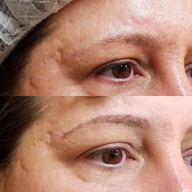 VibranceMediSpa's tweet photo. Microblading before and after. A picture says a thousand words. https://t.co/nXNx4sVMhX