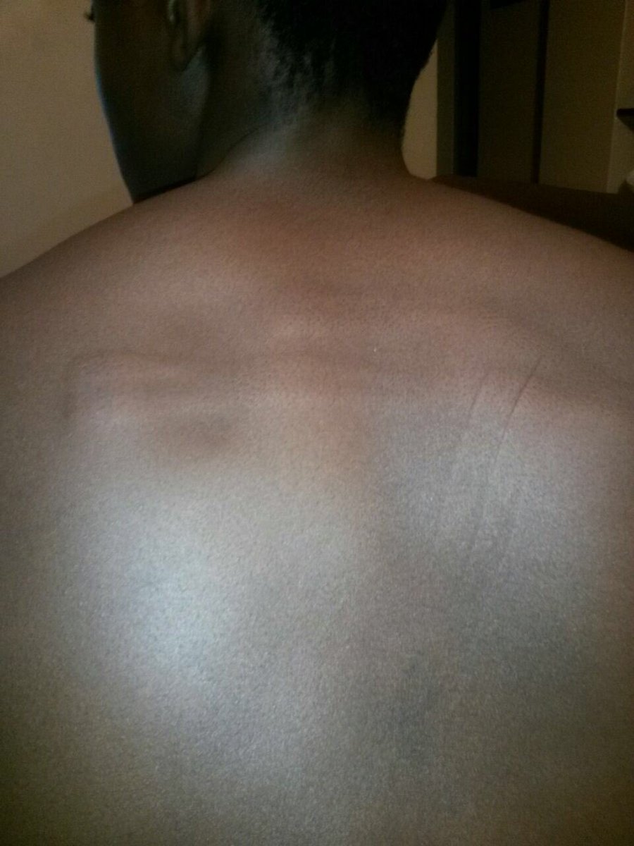Yonwaba_11's tweet photo. This man beat a friends younger brother with a pipe because he couldn’t understand how the promo code payment works. Don’t ask me how , so he beat him up and took his school bag then left him dry. 
Please watch out for this man. https://t.co/JCTI8rA5Rw