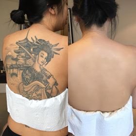 YLWeddingGuide's tweet image. Tattoos…are there occasions where you wish they would just disappear? 
bit.ly/2ImcygL