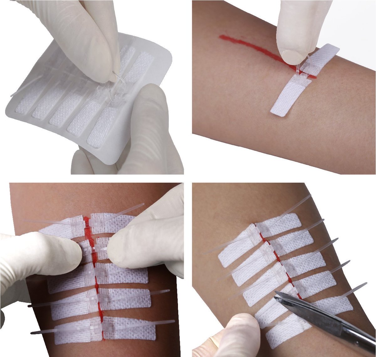DermaClip's tweet image. Effective for medical disaster situations and critical emergencies, DermaClip® provides the right option to #close_wounds efficiently and quickly!dermaclipus.com