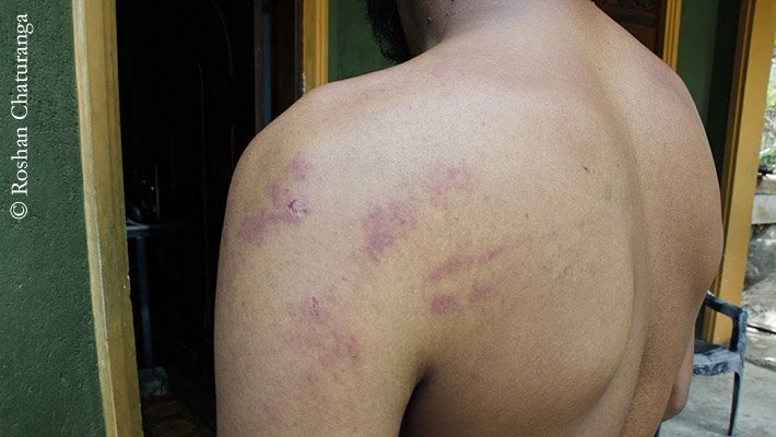 JDSLanka's tweet photo. “"#STF dragged us down the steps &amp; bound our hands &amp; feet. They beat us with wooden poles forcing to admit that we were plotting to attack #Sinhala shops."” - Abdul Saleel Mohamed Fazil #SriLanka #AntiMuslimViolence #lka #Digana #teldeniya https://t.co/oxoK1xd9ea https://t.co/kTP7O8NHm3