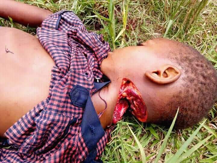 0xBillyon's tweet photo. If Buhari's Fulani Herdsmen  can do dis to a kid, who re you?
For me, I've sealed my mind to face d worst wen duty calls.
IPOB have continued to act as a friction towards their move in our land, bt unfortunately many of our people were viewing it from false angle.
Igbos Gt Ready! https://t.co/G1HVxIXrbS