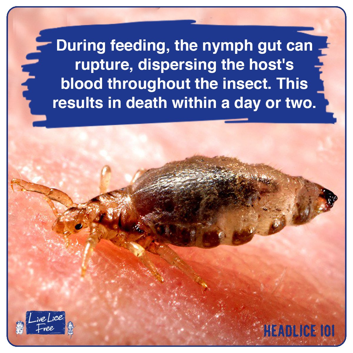 LiveLiceFree's tweet photo. Why doesn't it happen every time they start feeding?
#Headlice #Lice #Licefacts #headlicefacts #Livelicefree https://t.co/Ebdhljlh7Q