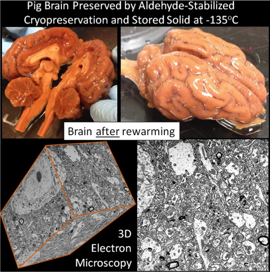 Lets_Upgrade's tweet photo. A technology to preserve synapses across the whole brain of a large mammal is successful as the final phase of our prize is won: https://t.co/I2Cb9gMPSG https://t.co/Eor5WyJIk9