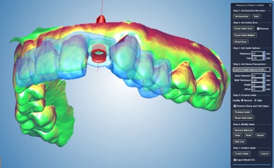 PlanmecaCADCAM's tweet photo. Gain confidence on implant treatments. Check out the Planmeca Romexis® Implant Guide module to eliminate the guesswork. #PlanmecaRomexis #PlanmecaUSA https://t.co/QdakG91wuP https://t.co/owKgzRefsO