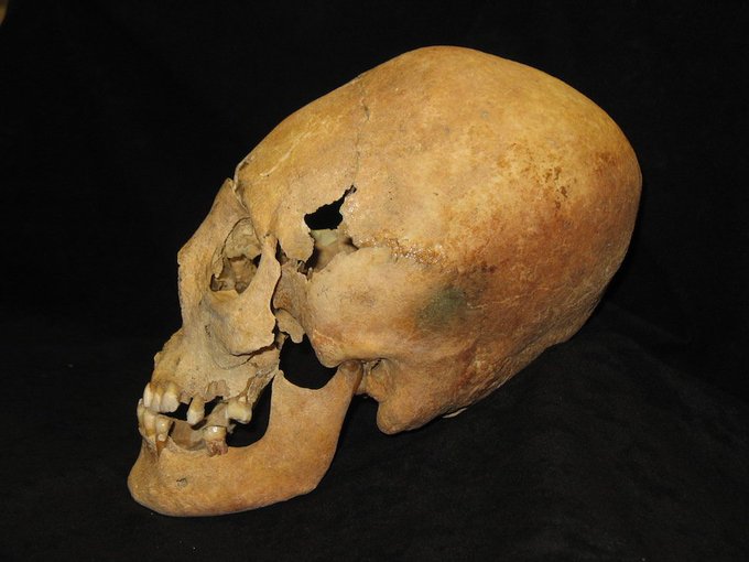 Skull of possible "bride" with elongated head