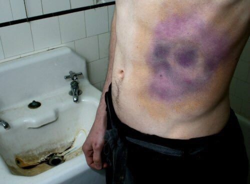 “ʜᴏᴡ ɪs ɪᴛ sᴏ ᴇᴀsʏ ғᴏʀ ʏᴏᴜ ᴛᴏ ʙᴇ ᴜɴᴋɪɴᴅ ᴛᴏ ᴘᴇᴏᴘʟᴇ?” ʜᴇ ᴀsᴋᴇᴅ.

    Ｍｉｌｋ ᴀɴᴅ Ｈｏｎｅｙᴅʀɪᴘᴘᴇᴅ 
ғʀᴏᴍ ᴍʏ ʟɪᴘs ᴀs ɪ ᴀɴsᴡᴇʀᴇᴅ,

“ʙᴇᴄᴀᴜsᴇ ᴘᴇᴏᴘʟᴇ ʜᴀᴠᴇ ɴᴏᴛ ʙᴇᴇɴ
ｋｉｎｄ ᴛᴏ ᴍᴇ.”

Ｒｅｖａｍｐｅｄ. 

ʀᴛ?