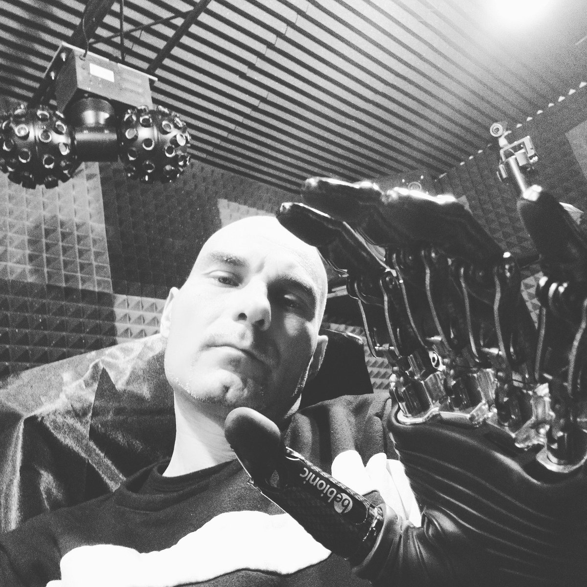 DBebionic's tweet image. #rekordbox #disabled #amputee #dj #house #bionic #bebionic #dance #fashion #free #pioneer #mix #dance  #beautiful  #amazing #cool #f4f #art #funny #istagram #love #talent #music #follow4like #like4like #follow4follow #firstpost #solocosebelle #amazing #roland