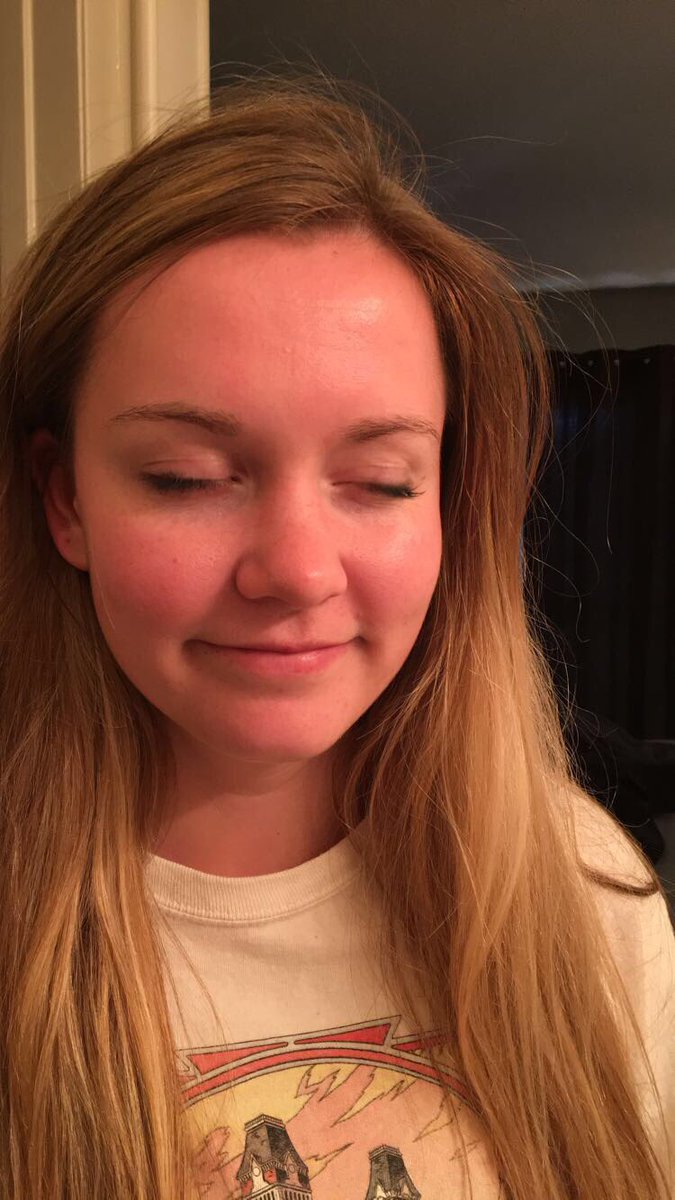 tri_connolly's tweet photo. @BigBreakPCB PSA: spf 50 sunscreen for kids may not work for 21 year olds. @JaisaMaloney @shelbyabbott #raccooneyes https://t.co/PNzY05gZKS