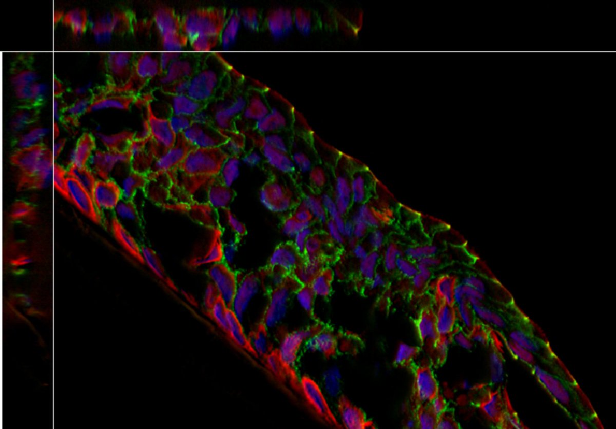 VolocityVQAR's tweet photo. #microscopy #Volocity #livecellImaging Volocity acquired by @Quorum_Tech https://t.co/Wk7fXPpUVT https://t.co/rp96D9m6Sp