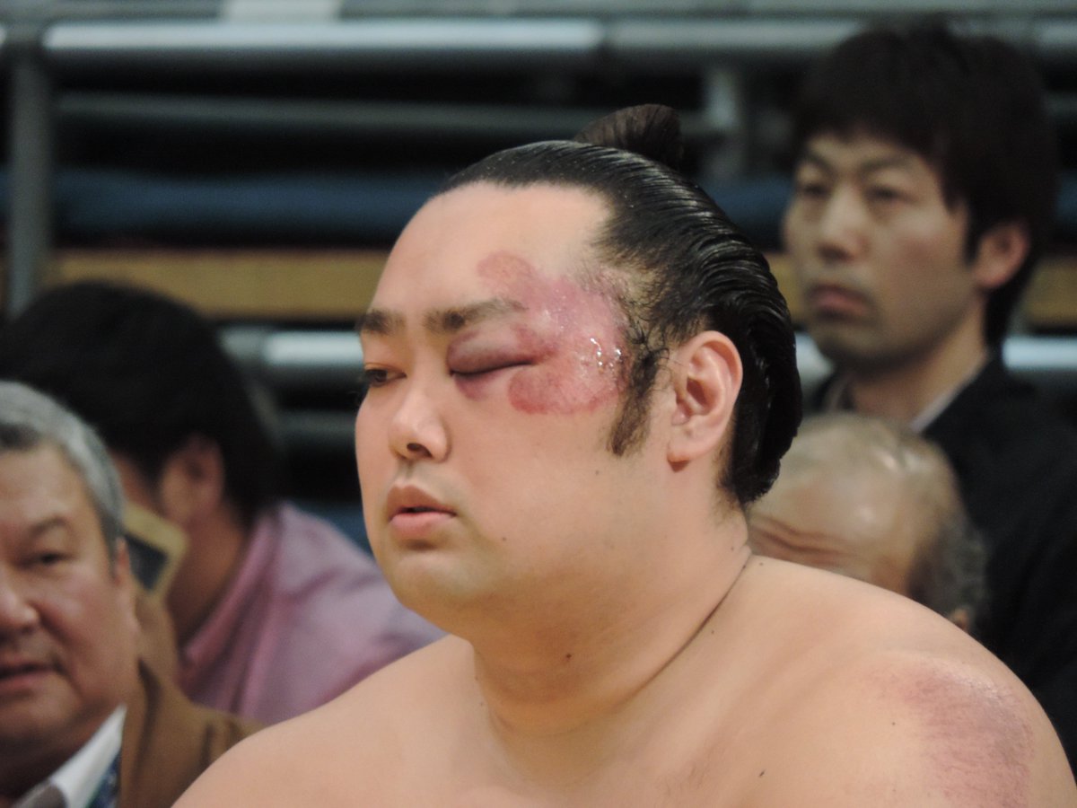 Twitter पर 大相撲名鑑 三日目の取組で顔から落ちて大流血の希善龍 T Co Gf2zkjayiu 平成27年三月場所でも投げの打ち合いから顔に大けがを負ったが千秋楽まで休まなかった 元は精悍な顔立ちのお相撲さん Twitter पर 大相撲名鑑 三日目の取組で顔から落ちて大流血の希善龍 T Co Gf2zkjayiu 平成27年三月場所でも投げの打ち合いから顔に大けがを負ったが千秋楽まで休まなかった 元は精悍な顔立ちのお相撲さん