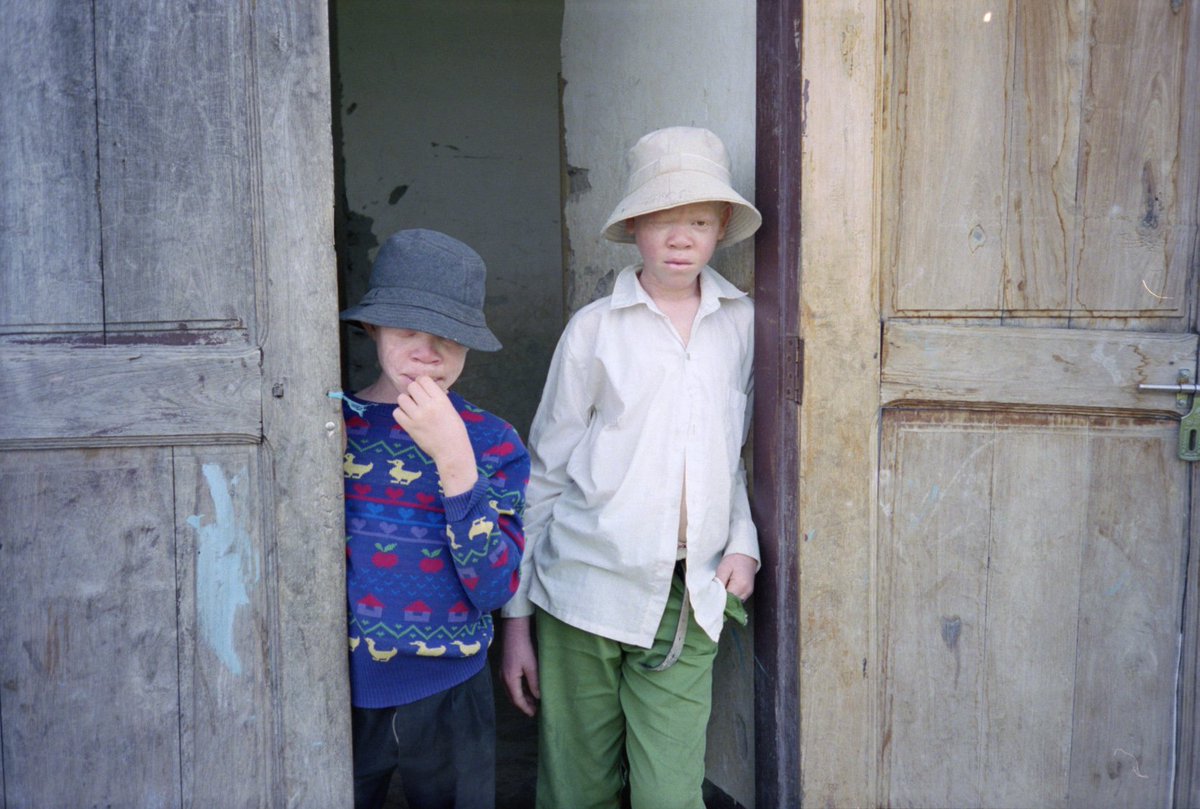 TribeofGhosts's tweet photo. @vanillablaq Hi i'm a film student from the Netherlands and i'm currently working on a documentary about children with albinism. This is the link to my crowdfund: https://t.co/6UXXXwcaBM Please share with your followers if you like. Thank you. https://t.co/CwP7p3nDag