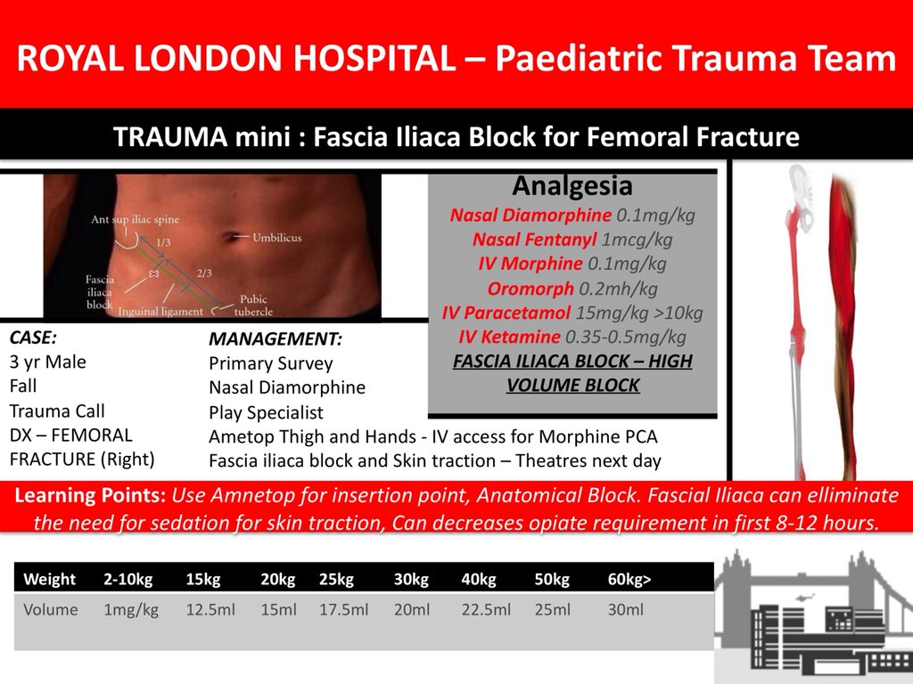 RLHPED's tweet photo. M&amp;M Learning points on Fascia Iliaca Blocks in kids #Anaesthetist #A&amp;E #Anaesthesiology #Trauma #TraumaMini #paediatrics #FOAMed @bredabon @naomi_edmonds @RLHTraumaTREATS @AnnielondonAA #learning #Education https://t.co/DLV7oo6LYw
