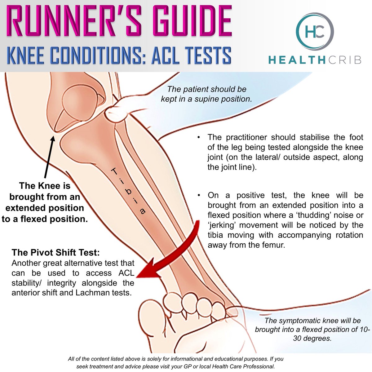 Healthcrib On Twitter The Pivot Shift Test An Alternative Test Normally Combined With The Anterior Shift And Lachman Tests Healthcrib Run Runner Tendons Ligaments Runningcommunity Kneesurgery Knee Kneepain Knjeeinjury Kneebrace