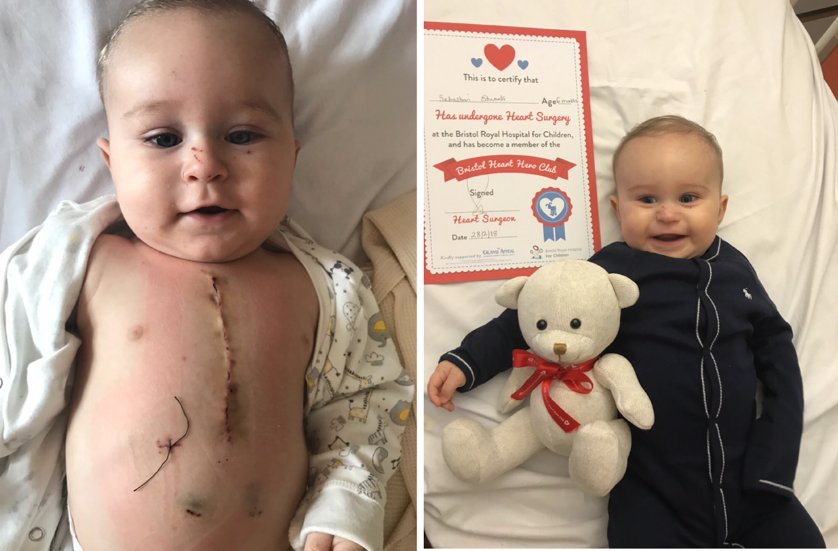 TheBHF's tweet photo. Little Sebastian returns home just five days after undergoing open heart surgery. What a trooper! https://t.co/QRMFvcOoaE