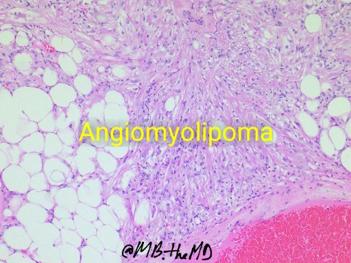 MB_thepathMD's tweet photo. And the answers are: #pathology #pathresident #GIpath #pathart #pathcases https://t.co/CmIiLI9lqJ