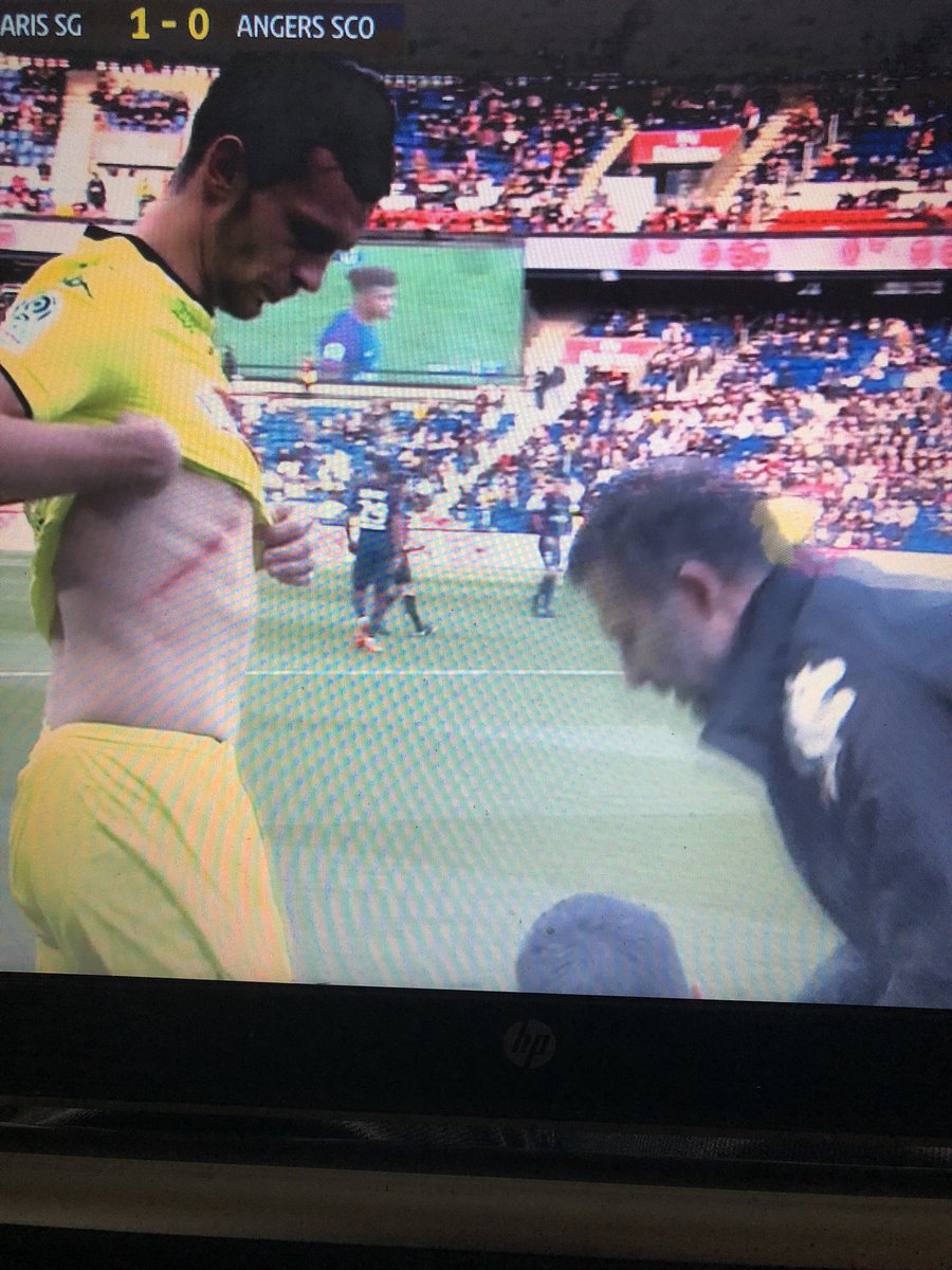 10SCOTY's tweet image. Nansss naaan j’ai ps toucheeew ! Gloire à Brandao pour son coup de tête dans la gueule de Motta, il le mérite, vraiment. #PSGSCO