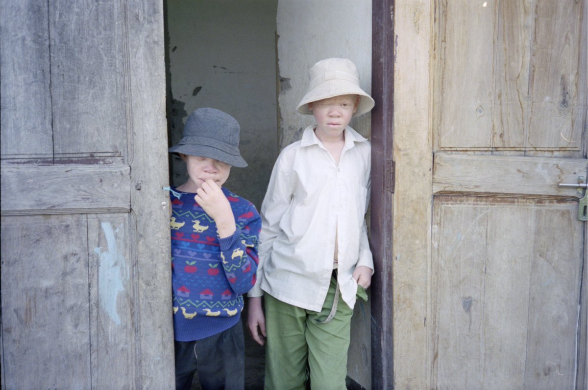 TribeofGhosts's tweet photo. @jeroenpauw Dag Jeroen, Mijn naam is Almicheal Fraay en ik wil een documentaire en fotoboek maken over kinderen met albinisme in Tanzania. Link: https://t.co/gL5jumNULw. Ik zou het zeer op prijs stellen als jij dit project wilt delen met jouw netwerk. Hartelijk dank. https://t.co/5VWBaQkm9c