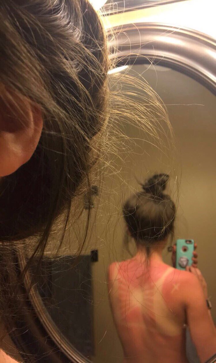allicrosby's tweet photo. One year ago me and Alexis go the best tan lines ever #springbreak2017
@alexisparke_ https://t.co/N2YfZxrzoK