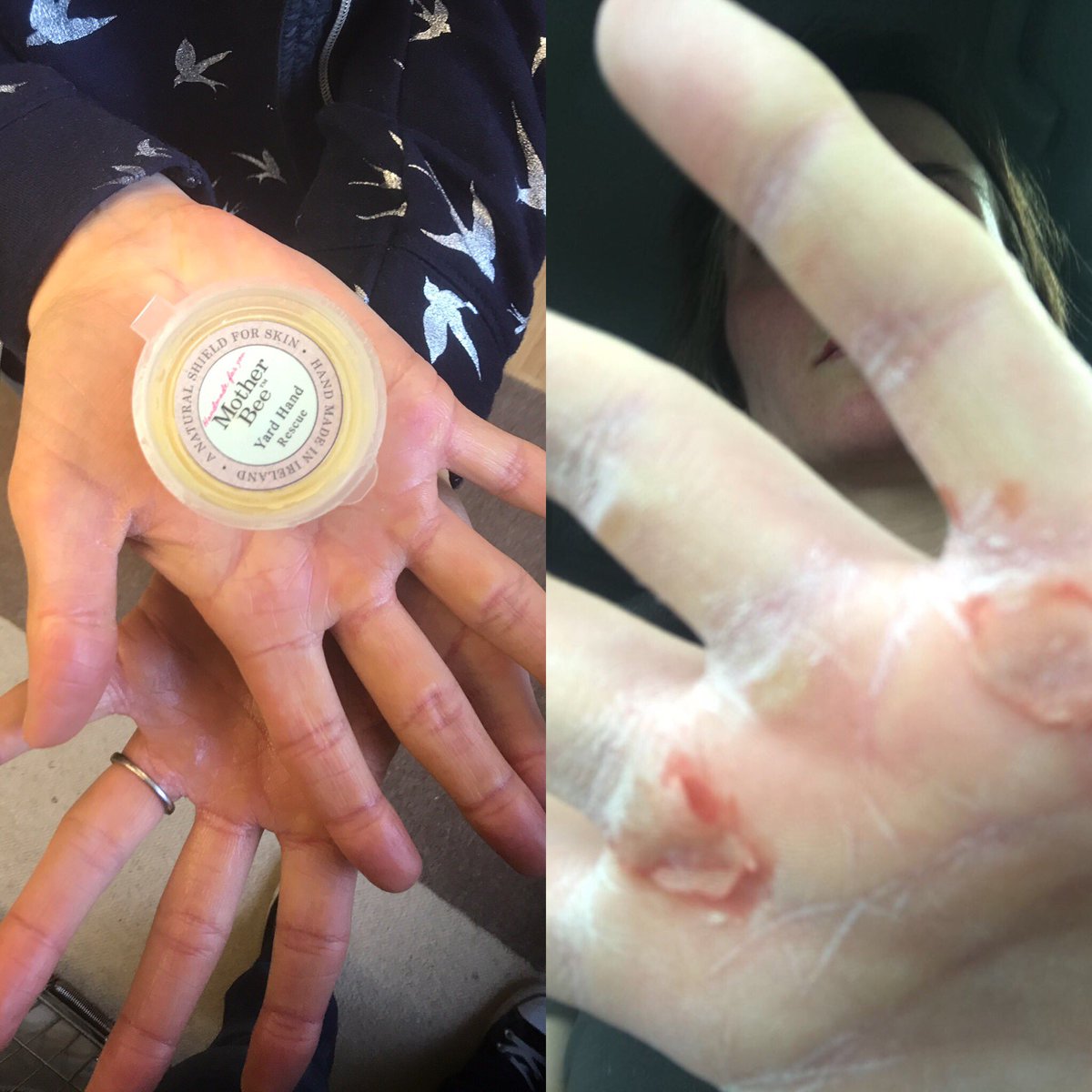 stablecare's tweet photo. Using Mother Bee hand wax for just a week, what a difference! #motherbee #yardhand #sport #stablecare #newmarket #healing #natural https://t.co/pMhcaEuHko