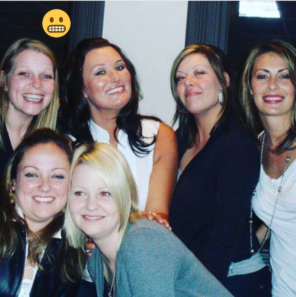 suuZeeQuZee's tweet image. How come when I smile all my teeth show both bottom and top #tomuch