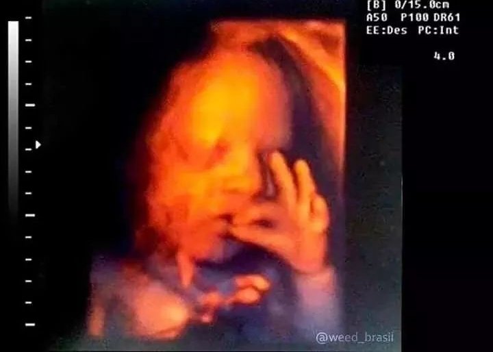 rbnalv7's tweet photo. Russia just sent for Britain on twitter but this baby ain't even born yet and knows how to deal with the pressure https://t.co/EE42tC0uI8