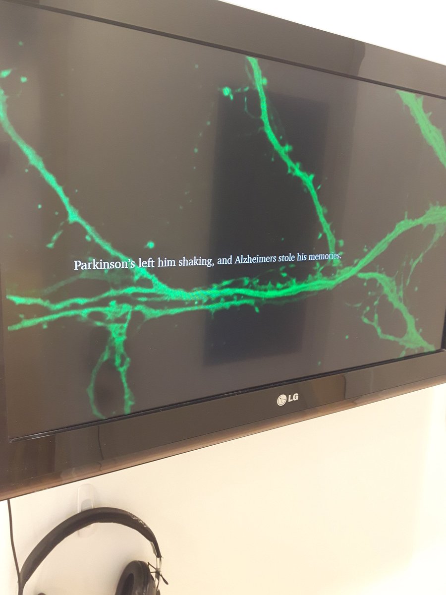 manitobaneuro's tweet photo. #Neurocraft meets #brainweek - Day 4!
"Fiddling Neurons" by Lesley Nakonechny, video, 2017
What is lost to Alzheimer's and what remains, set to music and the rhythm of firing neurons. #BrainAwarenessWeek
@CAN_ACN @dana_fdn @umanitoba @UM_RadyFHS @manitobacraft https://t.co/36wCsN5Msi