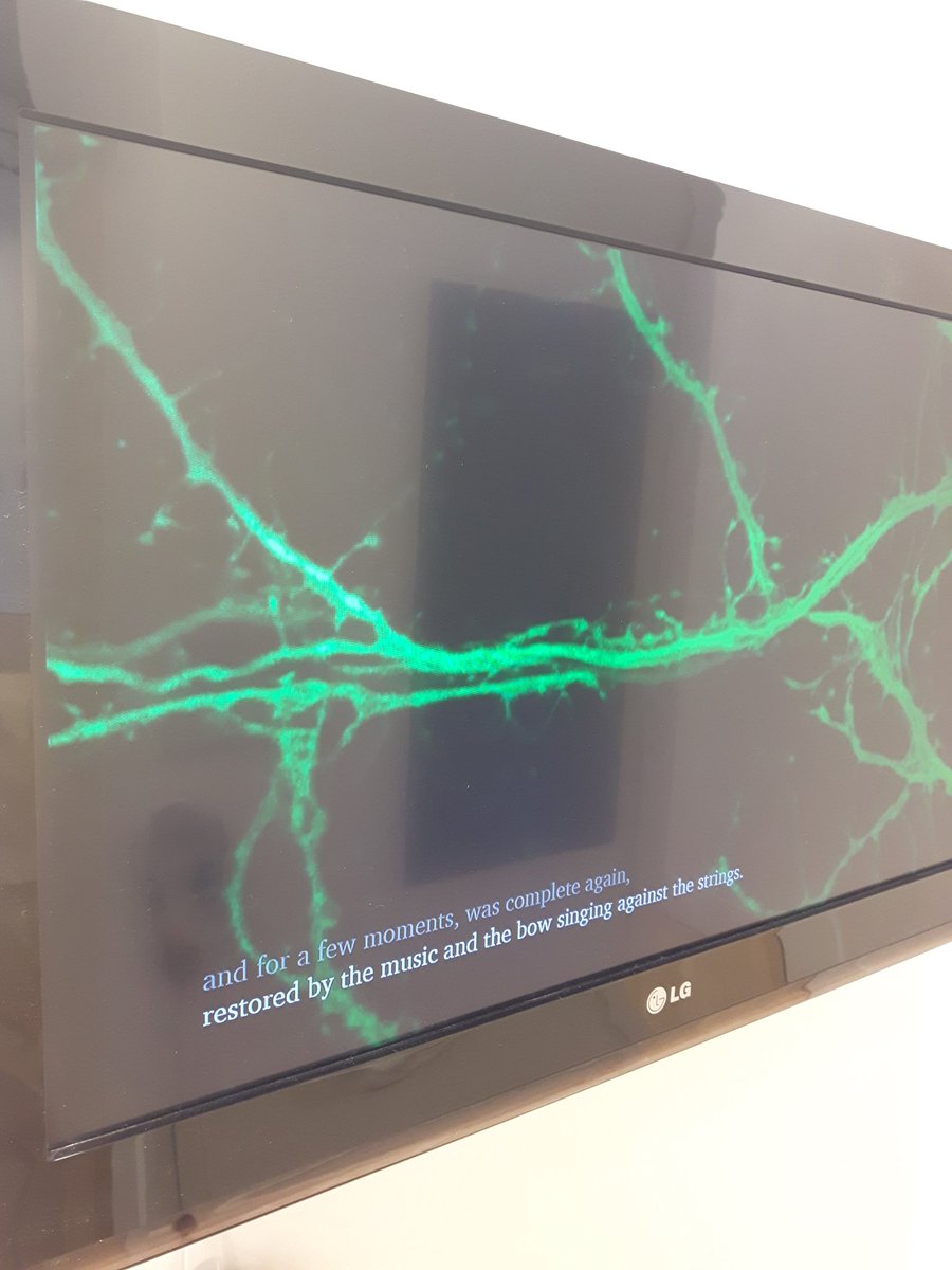 manitobaneuro's tweet photo. #Neurocraft meets #brainweek - Day 4!
"Fiddling Neurons" by Lesley Nakonechny, video, 2017
What is lost to Alzheimer's and what remains, set to music and the rhythm of firing neurons. #BrainAwarenessWeek
@CAN_ACN @dana_fdn @umanitoba @UM_RadyFHS @manitobacraft https://t.co/36wCsN5Msi