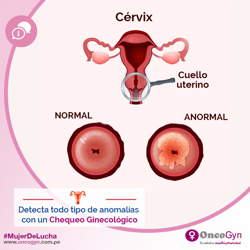 Ten una mayor detección de todo tipo de anomalías en el vulva, vagina, cuello uterino, útero, endometrio, trompas, ovarios y mamas.
Aprovecha el 20% de dscto en Chequeo Ginecológico todo marzo.
¡Solicítalo! oncogyn.com.pe/solicita-tu-ci…
#MujerDeLucha #Oncogyn #prevencion #CuelloUterino