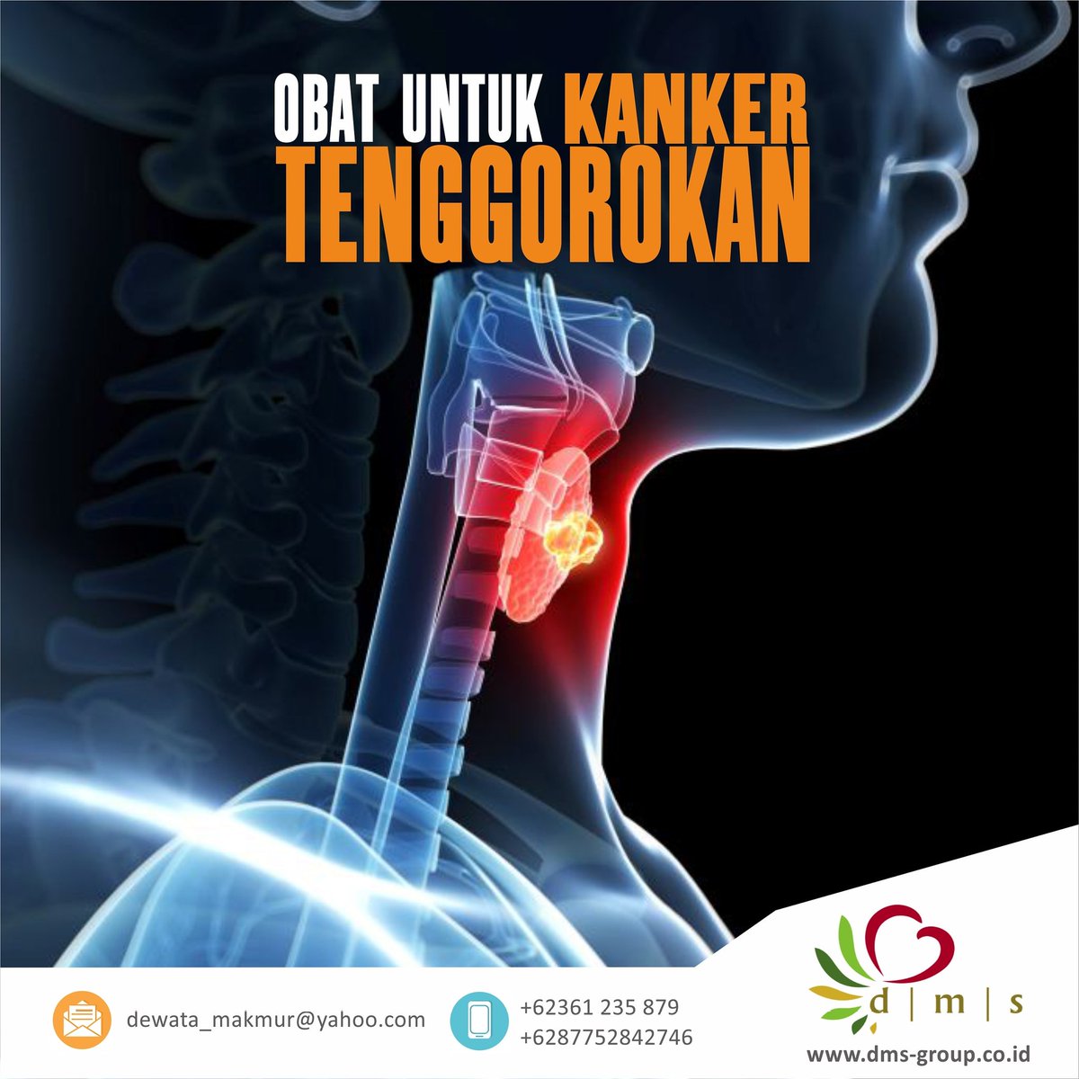 dmssolusikanker's tweet photo. Kanker Tenggorokan https://t.co/vNEhHyrws7 #TianXian #TianXianCapsule #Capsule5 #Kanker #KankerTenggorokan #SolusiKanker #ObatKanker #ObatKankerHerbal #ObatKankerTerbaik #Antikanker #IntegrativeMedicine #TianXianLiquid #TXL #Phytoceutical #DMSGroup https://t.co/hxbCIxQeTq