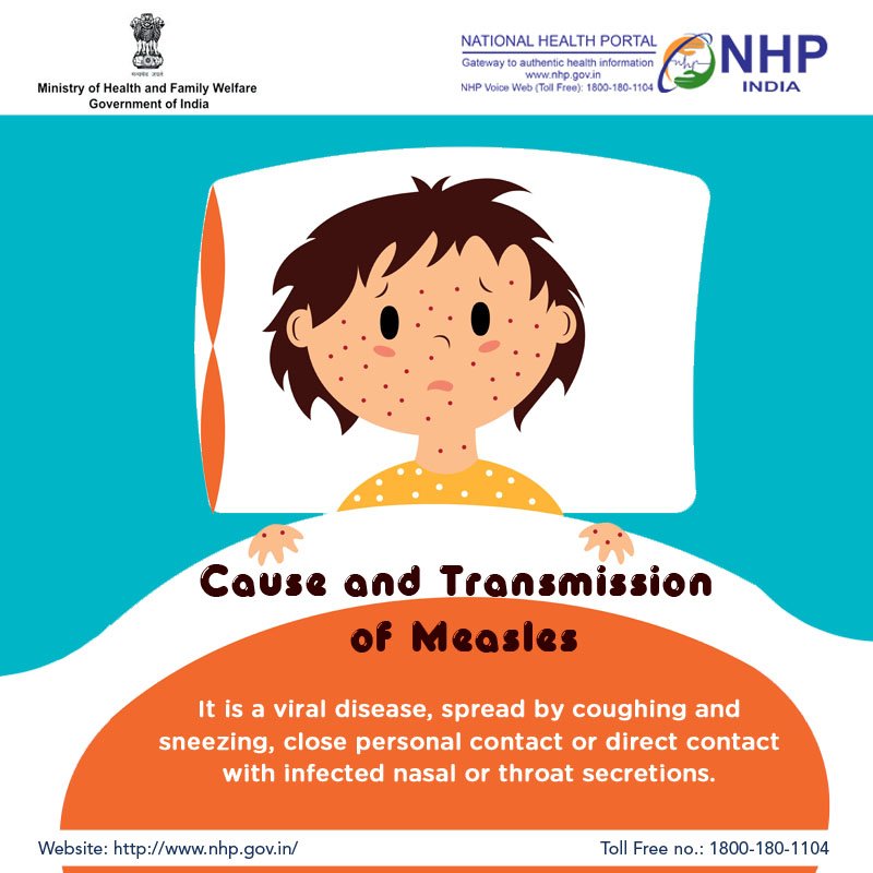 #Measles spreads by coughing and sneezing, close personal contact or direct contact with infected nasal or throat secretions.
To know more, visit: bit.ly/2tR9S7k
#SwasthaBharat #HealthForAll #MeaslesImmunizationDay