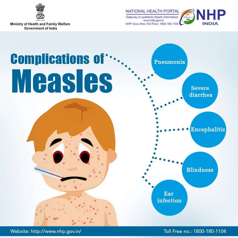 Checkout the complications that can be caused due to #Measles.
To know more, visit: bit.ly/2tR9S7k
#SwasthaBharat #HealthForAll #MeaslesImmunizationDay