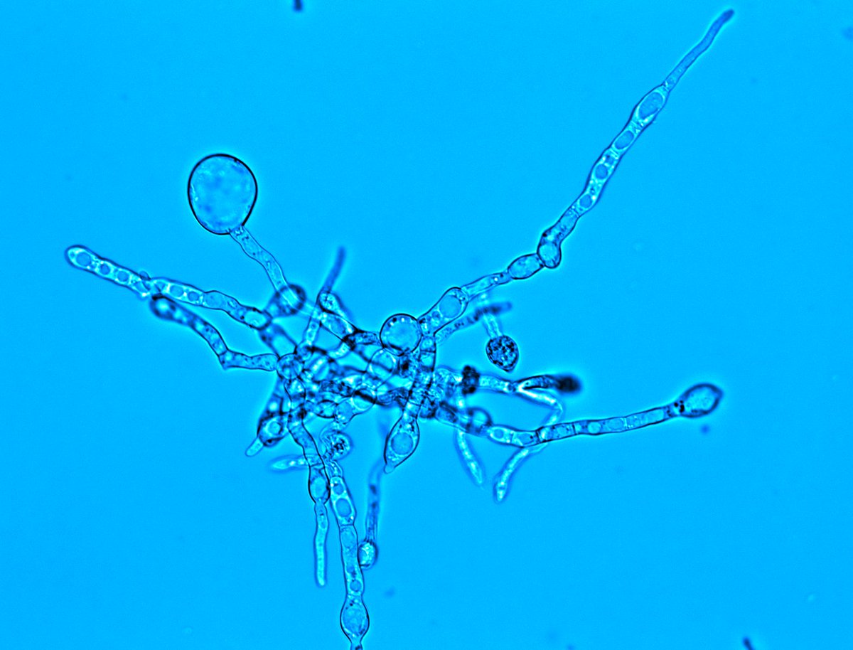 UofMMFIG's tweet photo. An interesting A. fumigatus phenotype spotted in Dr Amich’s (@JorgeAmich) lab. Have you seen a similar phenotype before? https://t.co/2seuOqqNWs