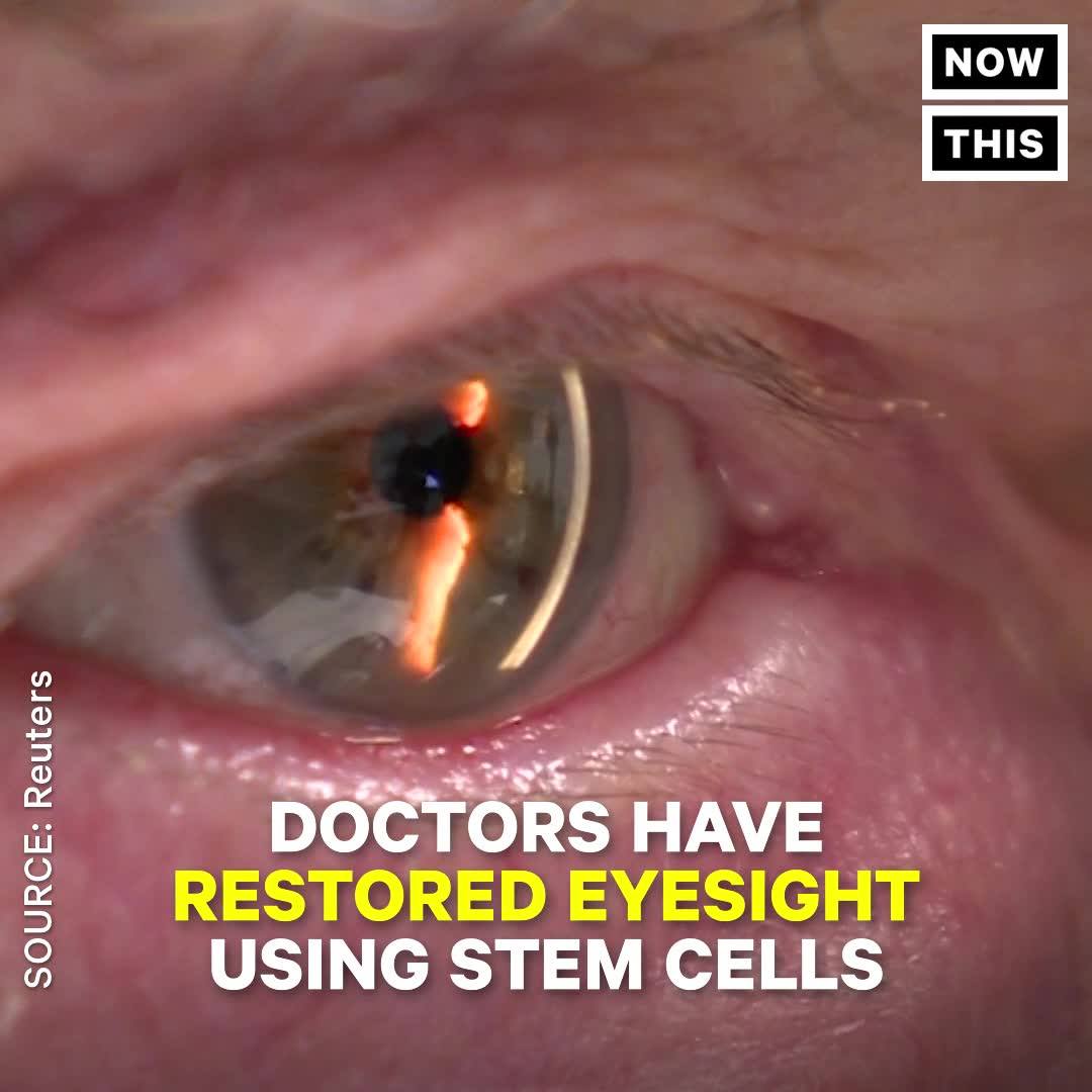 Doctors Are Using Stem Cells To Cure Visual Impairment lifeboat.com/blog/2018/03/d…