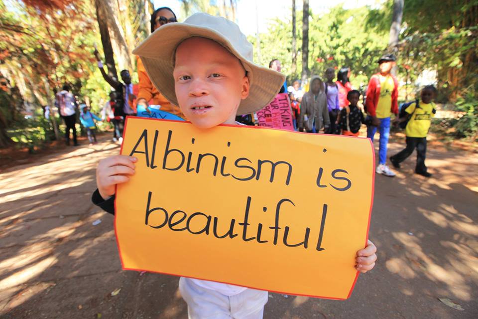 Sanelelesley2's tweet image. Can we give this boy 100 000 RTs and 500 000 likes.

#Albinism is beautiful.

Let do this......