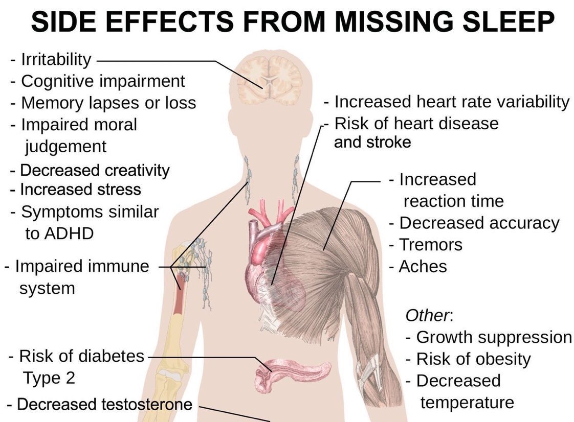 Side effects from missing sleep:

Irritability
Cognitive impairment
Memory loss
Impaired moral judgement
Decreased creativity
Risk of diabetes
Tremors
Aches
Impaired immune system
Heart disease
Obesity 
Stress
ADHD symptoms
Risk of stroke 
#WorldSleepDay wef.ch/2lsg4Pd