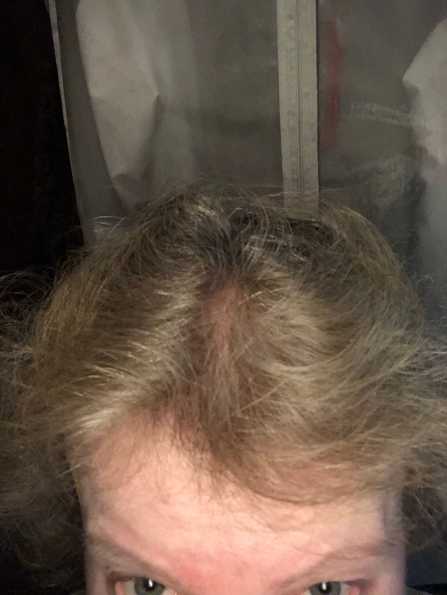 miezekatz2702's tweet photo. @Loreal #LOréal #Beauty #Ageperfect 
Ich durfte kostenlos die sanfte Pflege-Tönung testen. Ohne mischen im Haar verteilen. Kurz warten und graue Haare sind verschwunden. Es bleibt nichts als ein warmer, blonder Schimmer. Es pflegt, macht das Haar geschmeidig + leicht frisierbar. https://t.co/Ox4d9GJDje