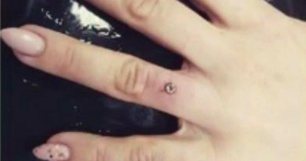 kfor's tweet image. Millennials replacing engagement rings with diamonds embedded in their fingers bit.ly/2HDkNnb