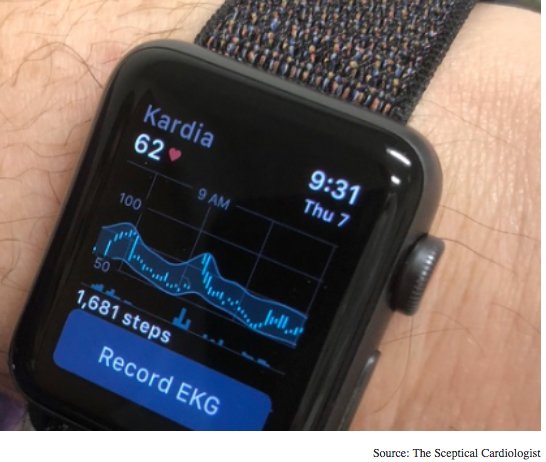 craig_silverman's tweet photo. Detecting hyperkalemia without blood tests @Berci #Cardiology https://t.co/B45ID9Yrzj #AppleWatch @drchrono #healthcare #practiceofthefuture https://t.co/kMWmh4BW8b