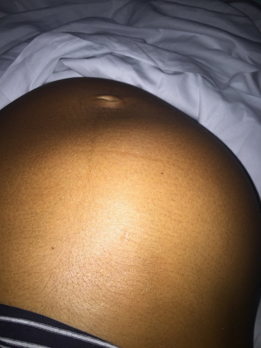 Birth story for baby number 2 👶🏽 georgiamariew.wordpress.com/2018/03/16/bir…