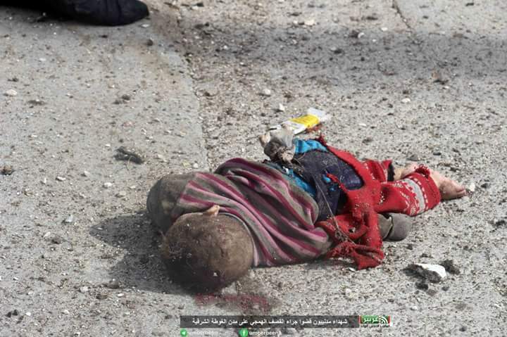 ThomasVLinge's tweet photo. I'm sorry for these horribly graphic photos but this is what's happening in eastern #Ghouta (#Syria), nobody is doing anything to stop it. 

Maybe I will get suspended for this but if we can't show the truth than why even bother being on here? https://t.co/YKNgdEollS