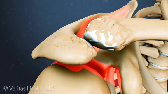 How to get Comfortable After Injuring Your Rotator Cuff
ow.ly/g5Rv30igHyH

#rotatorcuffinjury #rotatorcuffpain #shoulderpain