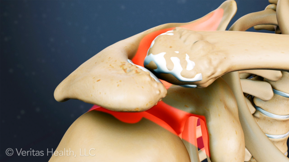 BrentMorrisMD's tweet photo. How to get Comfortable After Injuring Your Rotator Cuff
https://t.co/Z99vErUnmE
#rotatorcuffinjury #rotatorcuffpain #shoulderpain https://t.co/99tNDcN7Rn