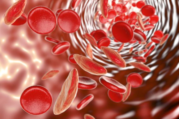 rdaniels1's tweet photo. When Will We Cure Sickle Cell Disease?   #sicklecell    #clinicaltrials
https://t.co/Ev853Htvf8 https://t.co/dPqPCSjs8d
