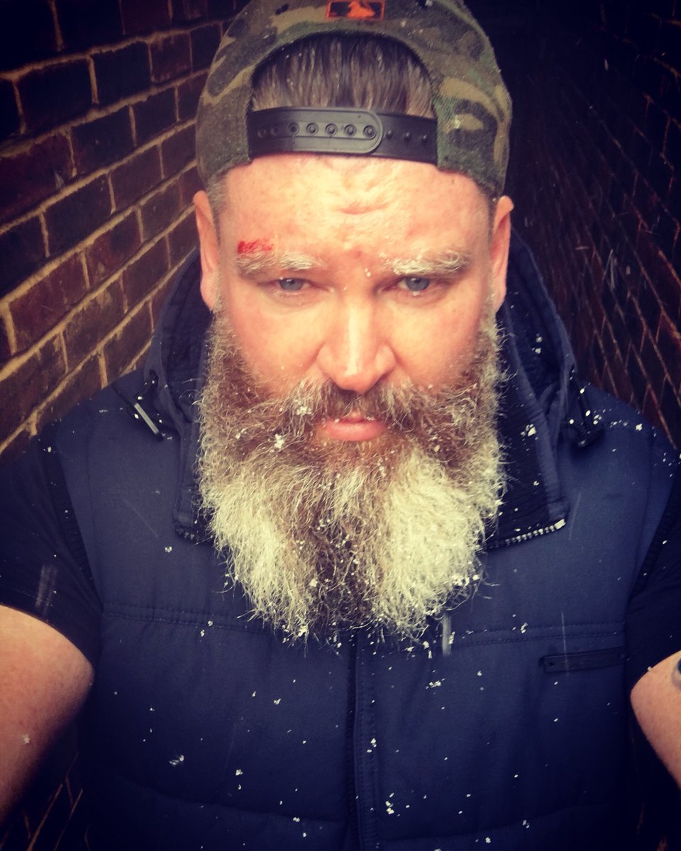 JamesWilmshurst's tweet photo. #BumpedHead #clumsy #selfie https://t.co/FngDokTVkg