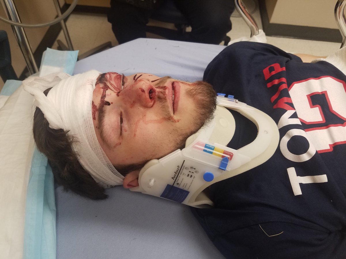 MikeRxqe's tweet photo. Hey everyone, there's probably not going to be videos for a while because last night I got into a major accident and ended up flipping and totaling my car - fractured 4 vertebrae in my back, my lung collapsed, and my hand is broken. 

I'll be back soon, take care everyone https://t.co/7FDktk6Esj