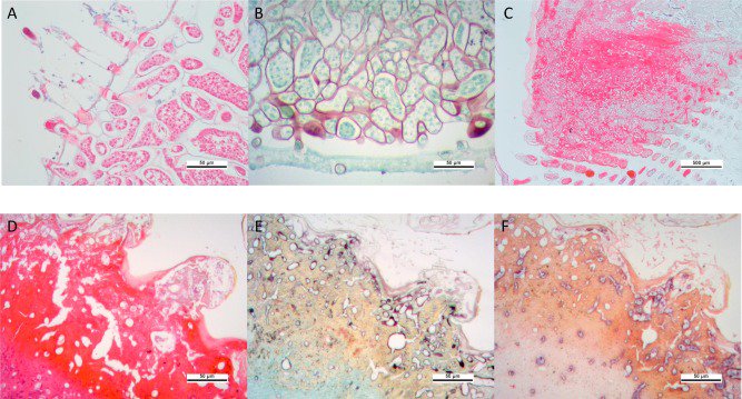 The pathogenic oomycete Halioticida noduliformans can infect the European lobster! 

Check out our new paper sciencedirect.com/science/articl…

With @MitoRem <a href="/LobsterGrower/">Lobster Grower</a> @grantstent <a href="/endomyxan/">David Bass</a> 
and @ExeterMarine <a href="/CefasGovUK/">Cefas</a> <a href="/PadstowLobster/">NationalLobsterHatch</a>
