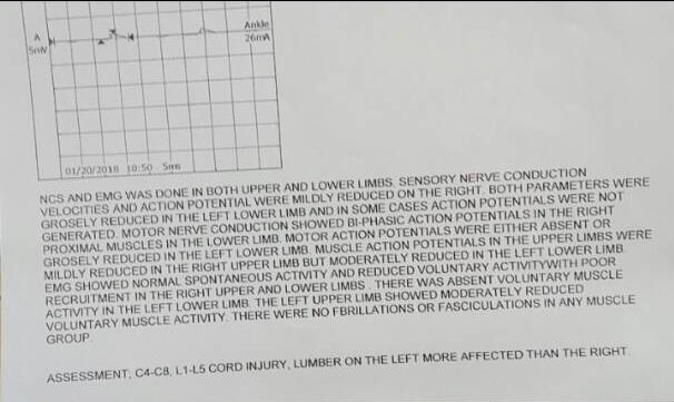 aushamaki's tweet image. People, please let's help a young boy in need. 14 year old Aliyu Shehu has been diagnosed with transverse myelitis and needs ₦3 million for surgery in India. ₦800,000 has been raised so far. Please donate what you can and help spread the word. Let's help Aliyu walk again.