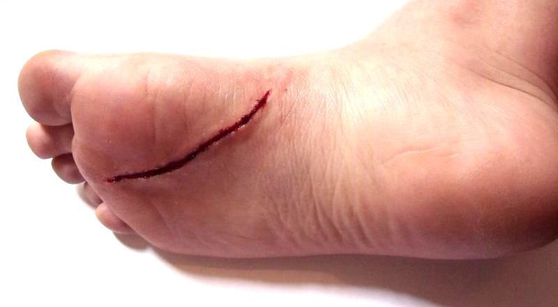 BatounX's tweet image. On connaît tous cette sensation quand on marche sur un Lego

Like et abonne toi c'est gratuit

Hashtags :#Enfoires2018 #ParisNice #Paris #Marseille #Nice #toulouse #cutestpet #iheartawards #Toulouse #MardiConseil #humour #humournoir #Noir #Blanco #PSLeDebat #Caen #LOSCMHSC #OLSMC